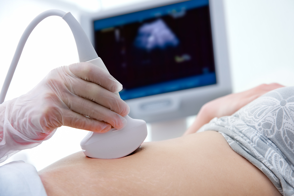woman getting an ultrasound.