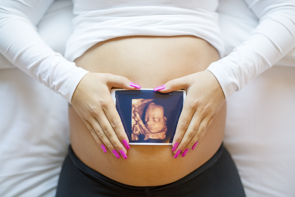 woman holding an ultrasound.